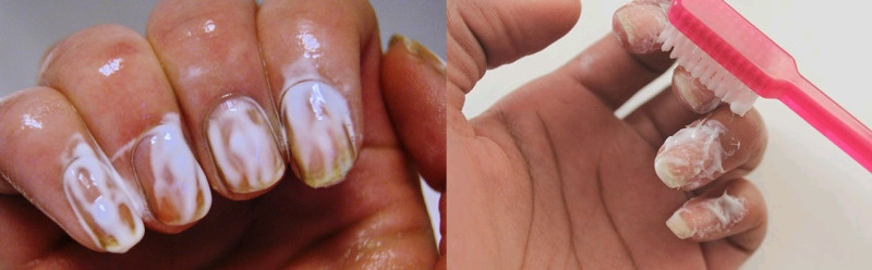 Tẩy sơn móng tay bằng kem đánh răng đảm bảo an toàn cho bộ móng